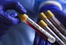 İsrail'de ilk kez Ebola şüphesiyle bir kişi karantinaya alındı