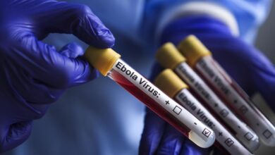 İsrail'de ilk kez Ebola şüphesiyle bir kişi karantinaya alındı